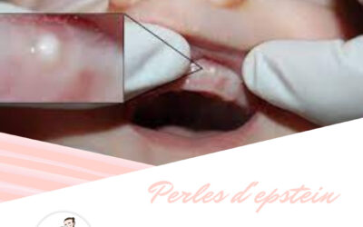 Les perles d&rsquo;esptein