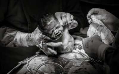 Récit d&rsquo;accouchement de Mochi